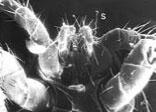 fot. 7. Spermatodaktyl (S), za pomocą którego samiec wprowadza nasienie do ciała samicy (fotografia z mikroskopu elektronowego)