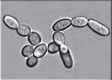 Ryc. 2 – Kolonia drożdży Zygosaccharomyces sp.;  (Fot. źródło: Wikipedia)