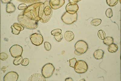 Pyłek kwiatowy pod mikroskopem