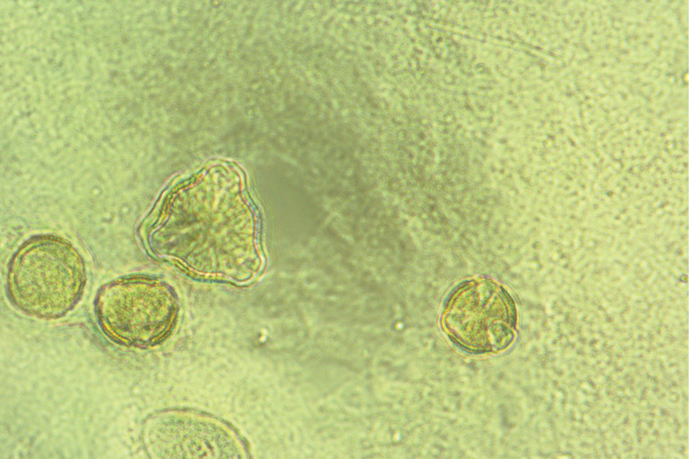 Obraz mikroskopowy osadu miodu malinowego, powiększenie 40×.
